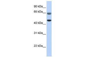 FAM113A antibody used at 1 ug/ml to detect target protein. (FAM113A antibody  (C-Term))