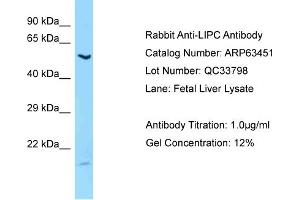 Western Blotting (WB) image for anti-Lipase, Hepatic (LIPC) (C-Term) antibody (ABIN2789506)