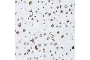 Immunohistochemistry of paraffin-embedded rat liver using NFKB2 Antibody. (NFKB2 antibody  (AA 690-899))
