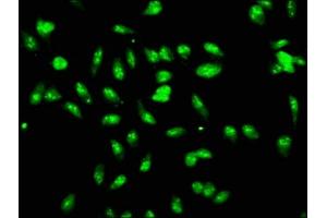 Immunofluorescence staining of Hela cells with ABIN7147315 at 1:166, counter-stained with DAPI. (LYAR antibody  (AA 1-379))