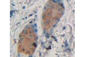#VALUE! (Cytokeratin 28 antibody  (AA 1-462))