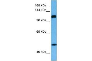 Host:  Rabbit  Target Name:  IFIH1  Sample Tissue:  Human Esophagus Tumor lysates  Antibody Dilution:  1ug/ml (IFIH1 antibody  (Middle Region))