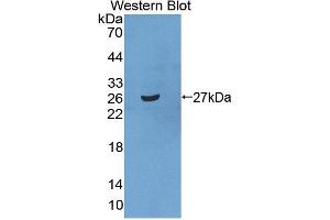 Figure. (SRPRB antibody  (AA 56-269))