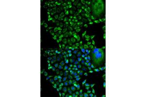 Immunofluorescence analysis of HeLa cell using PSMD10 antibody. (PSMD10 antibody  (AA 1-226))