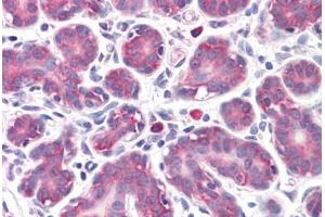 Human Breast: Formalin-Fixed, Paraffin-Embedded (FFPE) (GPR32 antibody  (AA 1-15))