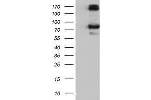 HEK293T cells were transfected with the pCMV6-ENTRY control (Left lane) or pCMV6-ENTRY CAPN9 (Right lane) cDNA for 48 hrs and lysed. (Calpain 9 antibody)