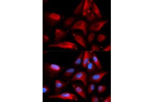 Immunofluorescence analysis of U2OS cells using S100A11 antibody (ABIN5973196).