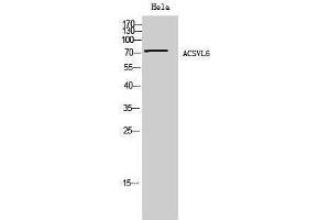 Western Blotting (WB) image for anti-Solute Carrier Family 27 (Fatty Acid Transporter), Member 5 (SLC27A5) (Internal Region) antibody (ABIN3183156) (SLC27A5 antibody  (Internal Region))