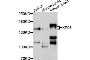 Western blot analysis of extracts of various cell lines, using XPO6 antibody (ABIN4905638) at 1:1000 dilution. (Exportin 6 antibody)