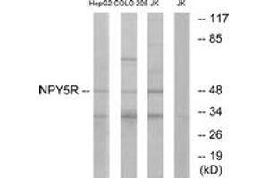Western blot analysis of extracts from COLO/Jurkat/HepG2 cells, using NPY5R Antibody. (NPY5R antibody  (AA 221-270))