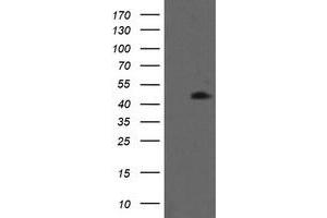 Image no. 1 for anti-Mitogen-Activated Protein Kinase Kinase 1 (MAP2K1) antibody (ABIN1499377) (MEK1 antibody)