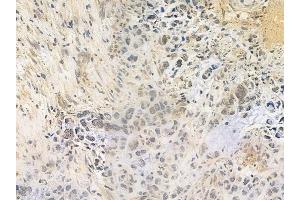 anti-Flightless I Homolog (FLII) (C-Term) antibody