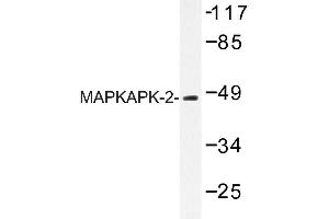 Image no. 1 for anti-Mitogen-Activated Protein Kinase-Activated Protein Kinase 2 (MAPKAPK2) antibody (ABIN272118) (MAPKAP Kinase 2 antibody)