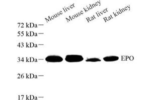 Western blot analysis of EPO (ABIN7073860) at dilution of 1: 500 (EPO antibody)