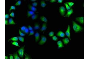 Immunofluorescence staining of Hela cells with ABIN7141990 at 1:100, counter-stained with DAPI. (MICAL1 antibody  (AA 806-1067))