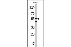 Western blot analysis of CA9 antibody in Hela cell line lysates (35ug/lane) (CA9 antibody  (AA 113-143))