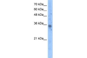 WB Suggested Anti-SLC25A16 Antibody Titration:  5. (SLC25A16 antibody  (N-Term))