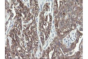 Image no. 2 for anti-Prefoldin Subunit 3 (PFDN3) antibody (ABIN1501702) (VBP1 antibody)