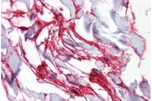 Human Colon, connective tissue: Formalin-Fixed, Paraffin-Embedded (FFPE) (Aquaporin 8 antibody  (AA 1-255))
