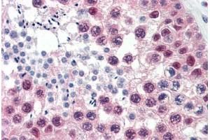 Human Testis (formalin-fixed, paraffin-embedded) stained with CUL1 antibody ABIN337174 at 10 ug/ml followed by biotinylated anti-mouse IgG secondary antibody ABIN481714, alkaline phosphatase-streptavidin and chromogen. (Cullin 1 antibody  (C-Term))