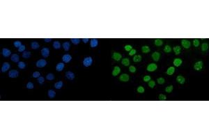 IF analysis of PARP using anti-PARP antibody (ABIN7602278). (PARP1 antibody  (AA 670-858))