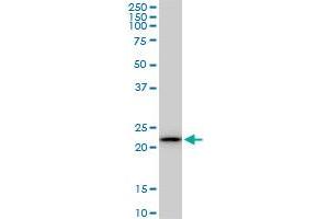 RPS5 monoclonal antibody (M01), clone 3G3.