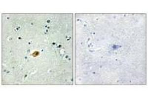 Immunohistochemistry analysis of paraffin-embedded human brain tissue using SOX8/9/17/18 antibody. (SOX8 antibody  (C-Term))
