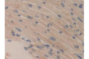 Detection of DLD in Mouse Heart Tissue using Polyclonal Antibody to Dihydrolipoyl Dehydrogenase (DLD) (DLD antibody  (AA 45-271))