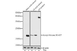 Western blot analysis of extracts of various cell lines, using Acetyl-Histone H3-K27 antibody (ABIN7267738) at 1:1000 dilution. (Histone H4 antibody  (H3K27))