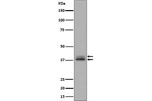 Western blot analysis of Phospho- Erk1 (T202/Y204) + Erk2 (T185/Y187) expression in A431 cell lysate treated with EGF.