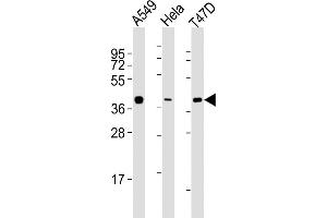 All lanes : Anti-ERCC1 Antibody (C-term) at 1:2000 dilution Lane 1: A549 whole cell lysates Lane 2: Hela whole cell lysates Lane 3: T47D whole cell lysates Lysates/proteins at 20 μg per lane.