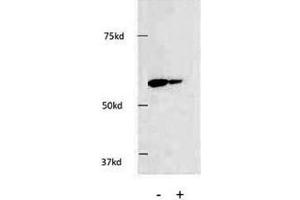 Western blot testing of HDAC1 antibody and HEK293 cells.