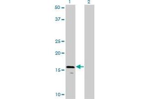 Western Blot analysis of AGTRAP expression in transfected 293T cell line by AGTRAP monoclonal antibody (M02), clone 1G2. (AGTRAP antibody  (AA 108-159))