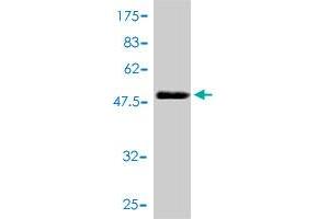 Western Blot detection against Immunogen (48. (CLTB antibody  (AA 1-211))