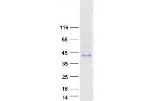 Western Blotting (WB) image for Acrosomal Vesicle Protein 1 (ACRV1) (Transcript Variant 1) protein (Myc-DYKDDDDK Tag) (ABIN2714342)