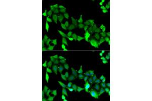 Immunofluorescence analysis of A549 cells using GRK6 antibody.