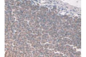 IHC-P analysis of Mouse Stomach Tissue, with DAB staining. (FAP antibody  (AA 542-761))
