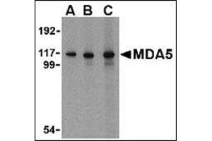 Western blot analysis of MDA5 in Daudi cell lysate with AP30553PU-N MDA5 antibody at 1 µg/ml (A), 2 µg/ml (B) and 4 μg/ml (C).