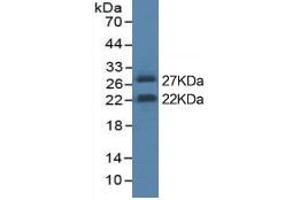 Rabbit Detection antibody from the kit in WB with Positive Control: Sample Cell culture supernatant of 293F cell which transfected with mouse IL6 gene. (IL-6 ELISA Kit)
