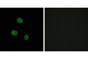 Peptide - +Immunofluorescence analysis of MCF-7 cells, using hnRNP M antibody.