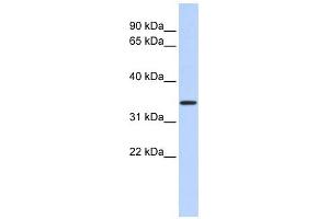 CCDC90A antibody used at 1 ug/ml to detect target protein. (CCDC90A antibody  (Middle Region))