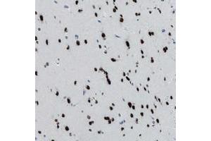 Immunohistochemical staining of human cerebral cortex with TTC13 polyclonal antibody  shows strong nuclear positivity in neurons at 1:20-1:50 dilution. (TTC13 antibody)