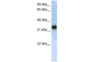 Western Blotting (WB) image for anti-Zinc Finger, CCHC Domain Containing 17 (ZCCHC17) antibody (ABIN2458243) (ZCCHC17 antibody)
