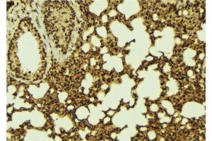 ABIN6267096 at 1/100 staining Mouse lung tissue by IHC-P. (BCL9L antibody  (pSer915))