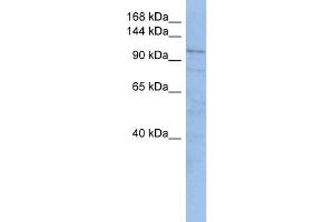 WB Suggested Anti-TRAK1  Antibody Titration: 0. (TRAK1 antibody  (Middle Region))