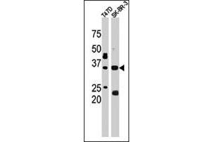 The ICMT polyclonal antibody  is used in Western blot to detect ICMT in T-47D (left) and SK-BR-3 (right) cell lysates. (ICMT antibody  (C-Term))