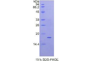 SDS-PAGE (SDS) image for Quiescin Q6 Sulfhydryl Oxidase 1 (QSOX1) (AA 37-181) protein (His tag) (ABIN1878308)
