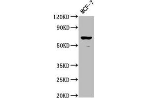 Western Blot Positive WB detected in: MCF-7 whole cell lysate All lanes: RPE65 antibody at 1:2000 Secondary Goat polyclonal to rabbit IgG at 1/50000 dilution Predicted band size: 61 kDa Observed band size: 61 kDa (RPE65 antibody  (AA 348-484))