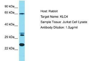 Host: Rabbit Target Name: KLC4 Sample Tissue: Human Jurkat Whole Cell Antibody Dilution: 1ug/ml (KLC4 antibody  (N-Term))