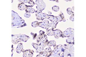 IHC analysis of CFP using anti-CFP antibody (ABIN6719298). (CFP antibody)